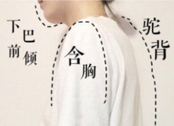 南寧美容學校：堅持一個月，駝背變直背