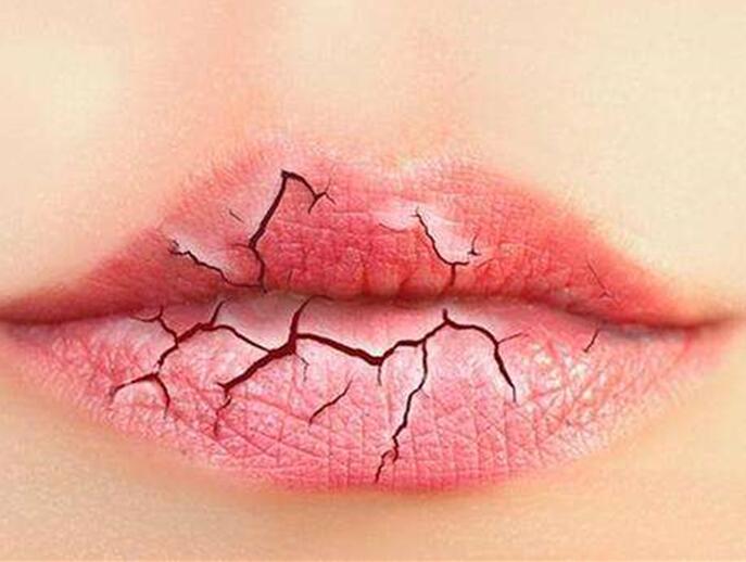 6個(gè)美容技巧，解決秋季嘴唇干燥