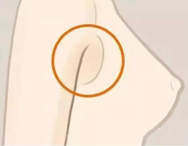 減副乳，瘦手臂一招就解決！