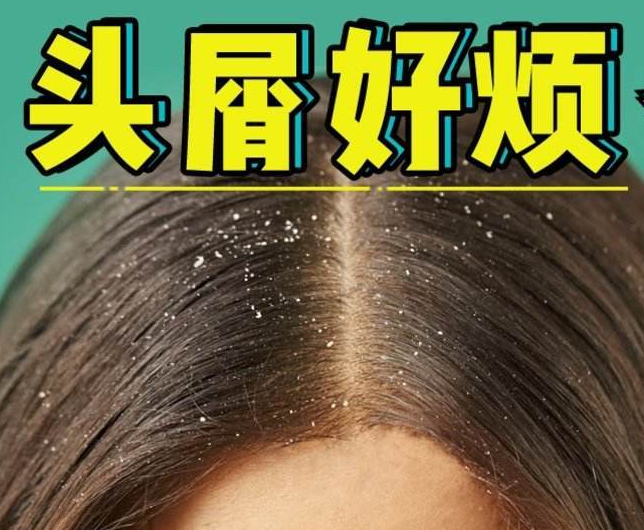 南寧正規(guī)美發(fā)培訓(xùn)學(xué)校分享：冬天如何減少頭屑過多？