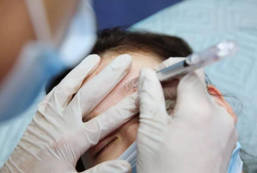 紋繡遇到容易出血的皮膚怎么辦？南寧專業(yè)紋繡培訓(xùn)教你