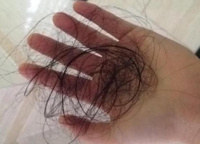 脫發(fā)女孩必備寶典！南寧美發(fā)學(xué)校教你