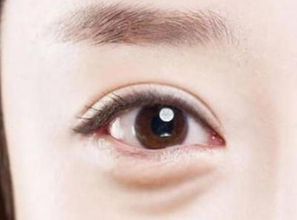 眼袋？淚溝？臥蠶？南寧美容學校教你辨別