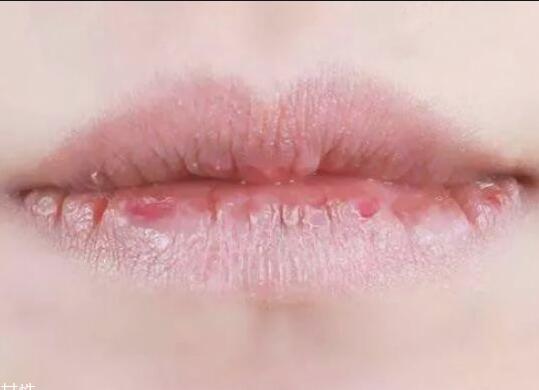 紋唇后嘴巴干燥怎么辦？南寧教紋繡的學(xué)校幫你解決