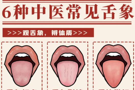 6種常見中醫(yī)舌診判定，快和廣西中醫(yī)美容一起學