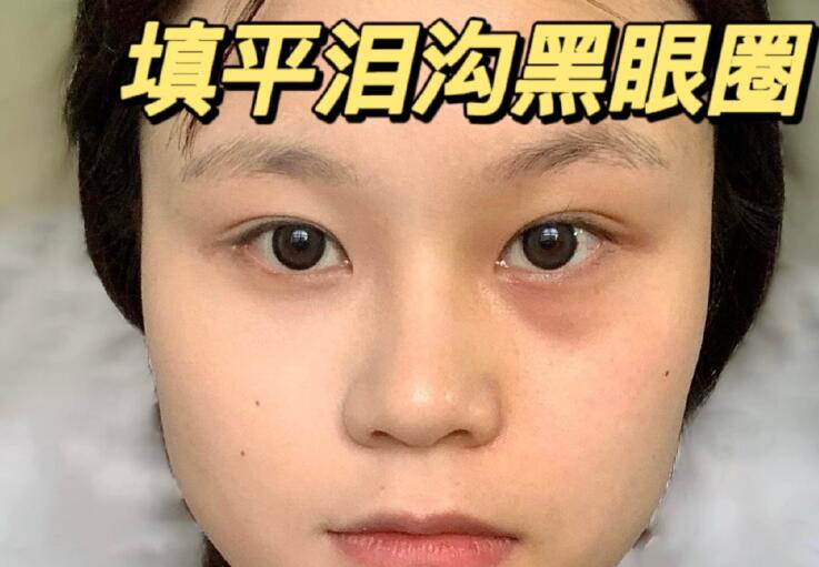 填平淚溝黑眼圈教程，廣西南寧化妝學校分享