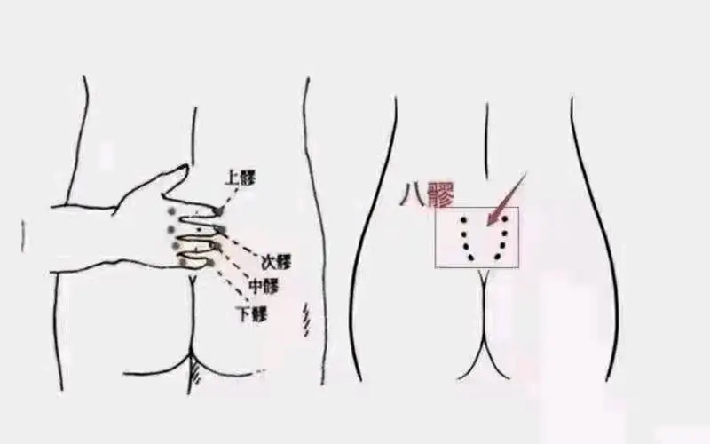 疏通八髎注意事項(xiàng)，南寧中醫(yī)美容學(xué)校培訓(xùn)內(nèi)容