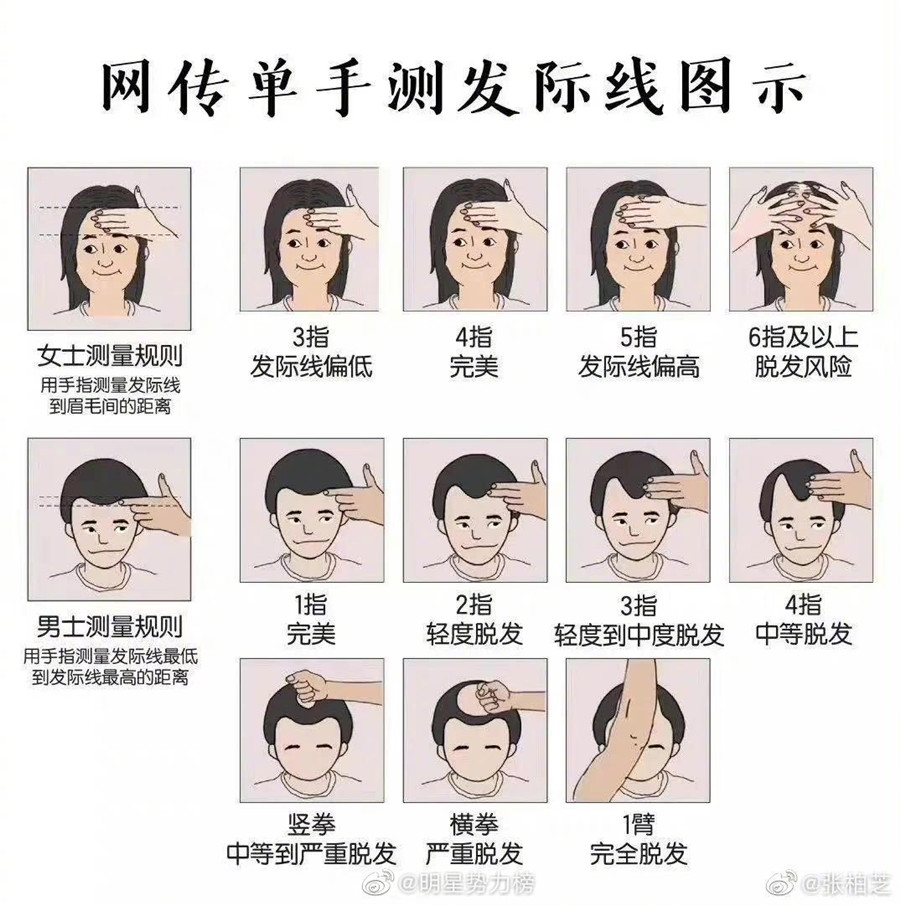 廣西頭療養(yǎng)發(fā)培訓(xùn)：?jiǎn)问譁y(cè)發(fā)際線教程