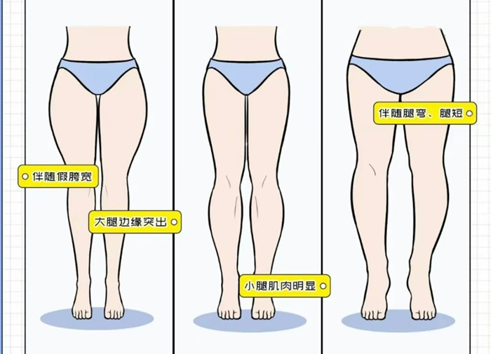 腿粗女生穿搭攻略，廣西彩妝造型搭配