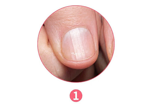 女生氣血不足六大表現(xiàn)，南寧美容養(yǎng)生資訊報(bào)道