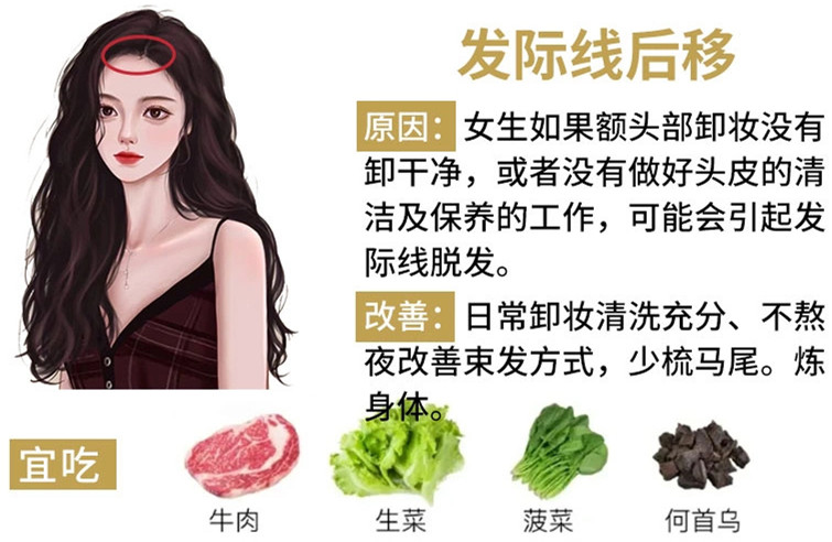 如何改善掉頭發(fā)？南寧頭療養(yǎng)發(fā)護(hù)發(fā)教學(xué)