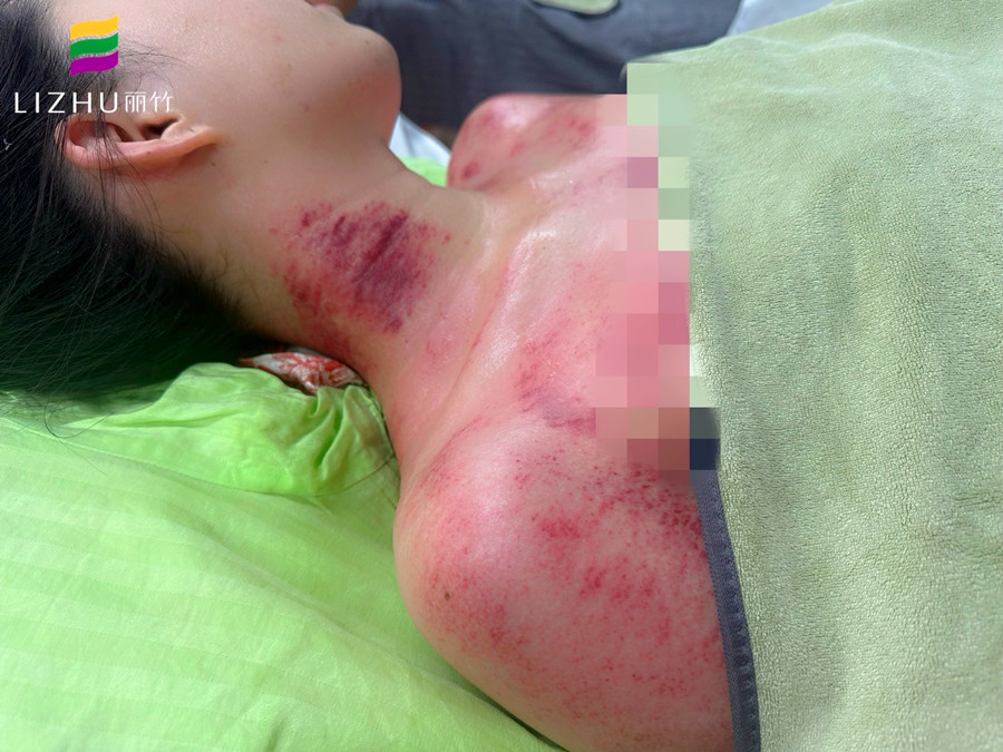 廣西學刮痧培訓班 | 廣西學刮痧學費多少？