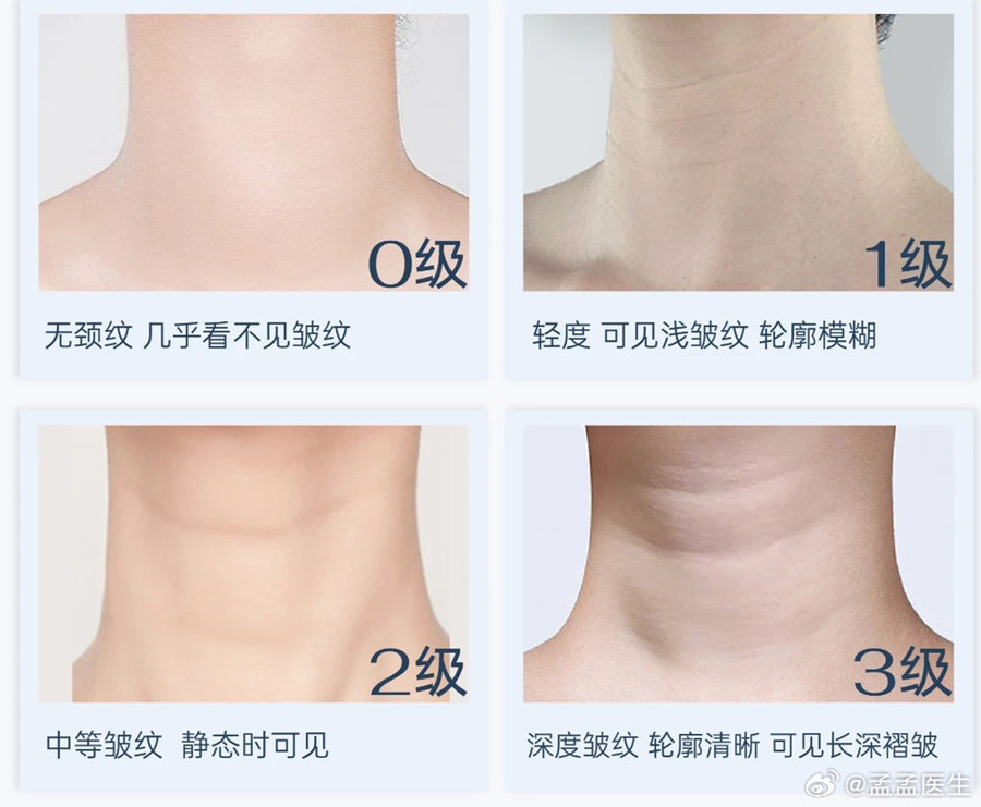 如何緩解頸紋？南寧美體美容管理培訓(xùn)