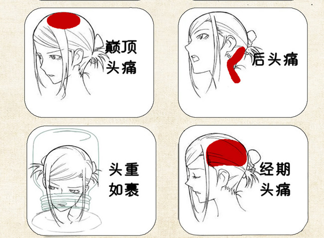不同頭痛類型經(jīng)絡(luò)護(hù)理方法，廣西中醫(yī)美容培訓(xùn)