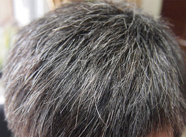 南寧美發(fā)基礎(chǔ)教學(xué)：為什么會長白頭發(fā)？