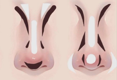 廣西習(xí)化妝排名：不同鼻型如何修容？